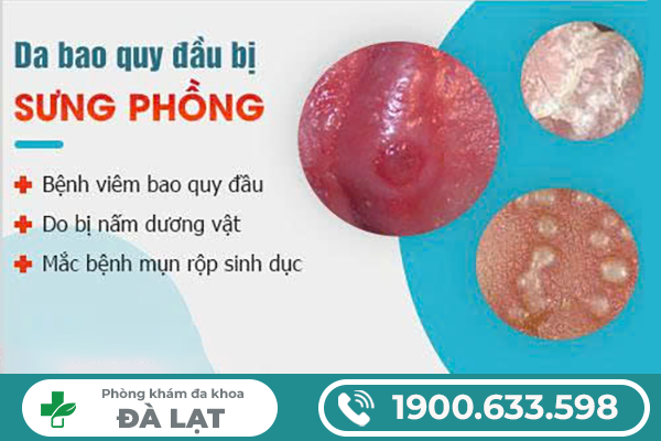 Hình ảnh minh họa